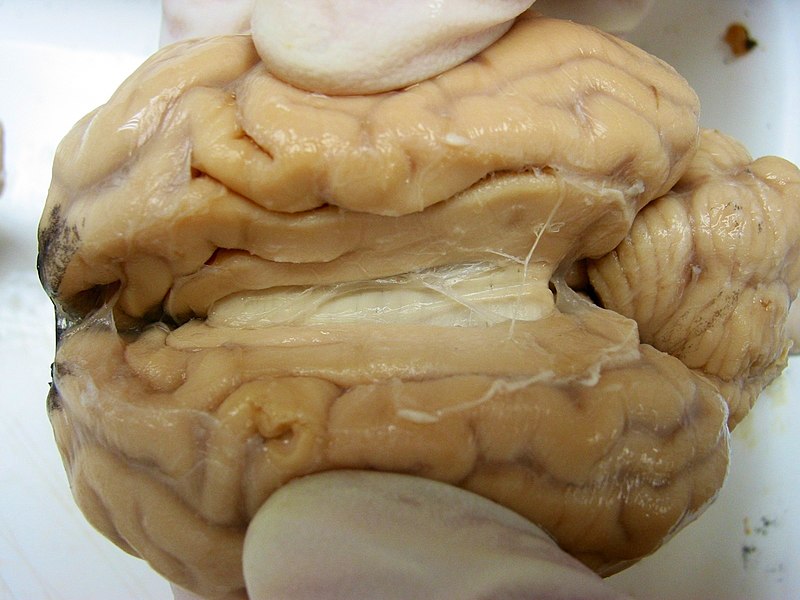 File:Sheep Brain Dissection edited.jpg