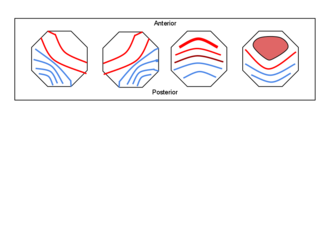 Typical 4-class microstate topography sequence. From left to right: Classes A, B, C, and D Untitleddrawing-2.png