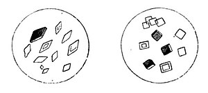 Uric acid crystals.jpg