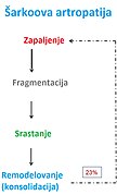 Šarkoova artropatija.jpg