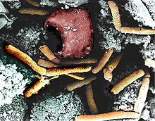 Anthrax color enhanced micrograph.JPG