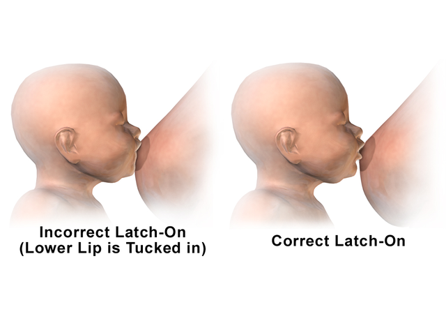 File:Breastfeeding - Incorrect vs Correct Latch-On.png - Wikipedia