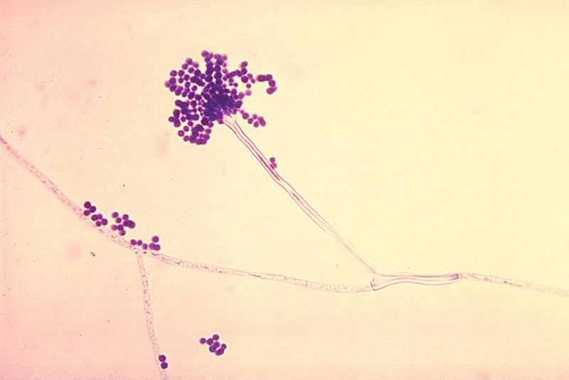 File:Conidia phialoconidia of Aspergillus fumigatus PHIL 300 lores.jpg