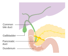 Union of common bile duct and pancreatic duct terminating at duodenum (small intestine). Diagram showing the bile ducts in the pancreas CRUK 293.svg