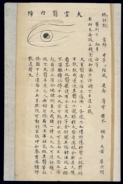 File:Illustration from Ming Chinese ophthalmology text, Ms copy Wellcome L0039702.jpg