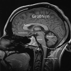 Gehirn: Etymologie, Gehirn der Wirbeltiere, Menschliches Gehirn