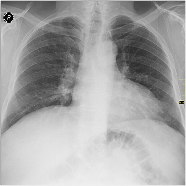 File:Medical X-Ray imaging SJY07 nevit.jpg