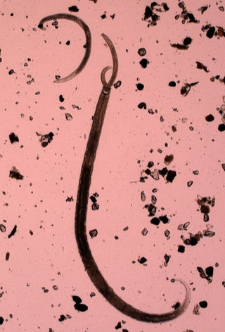 <span class="mw-page-title-main">Adenophorea</span> Class of roundworms