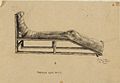 Tarsoa Leg Rest, 1944 Art.IWMARTLD6634.jpg