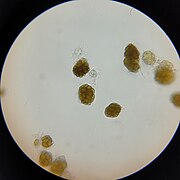 Urocystis primulae spore balls.jpg