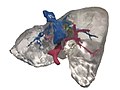 3D printed liver model.jpg