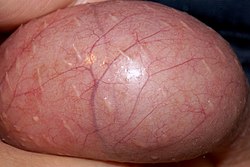 A close-up of a human testicle.jpg