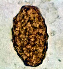 roundworms eggs in humans