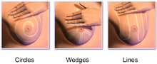 Methods for breast palpation Blausen 0144 BreastSelfExam 3Methods.png