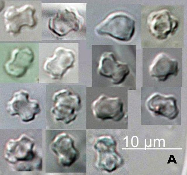 File:Boletopsis nothofagi spores.jpg