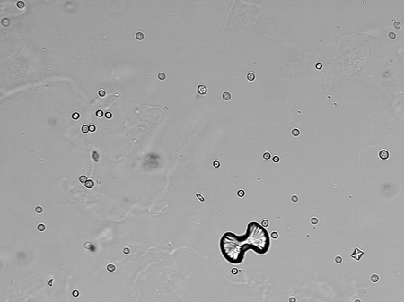 Calcium oxalate crystals (urine) - kalsiyum oksalat kristalleri (idrar) - 01.png