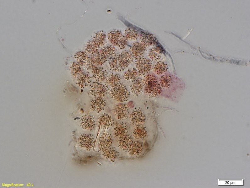 File:Collection Penard MHNG Specimen 99-1-3 Chlamydomyxa montana.tif