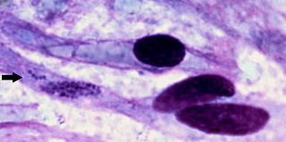 <i>Ehrlichia ruminantium</i> Ruminant disease