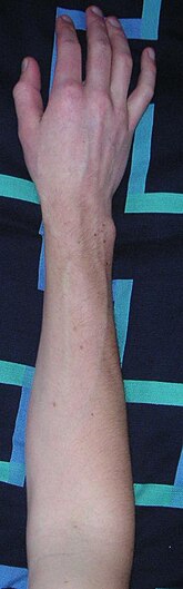 Forearm.jpg