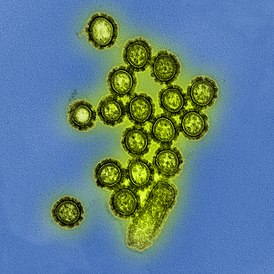 H1N1 influensaviruspartikler (8411599236).jpg