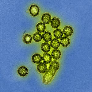H1N1 Influenza Virus Particles (8411599236).jpg