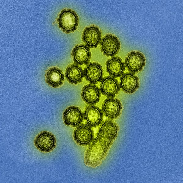 File:H1N1 Influenza Virus Particles (8411599236).jpg