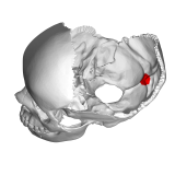 Internal occipital protuberance3.png