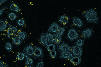 Pathogenic bacterium Pseudomonas aeruginosa (yellow) infects and kills a cell culture of lung epithelial cells (blue). Benoit-Joseph Laventie 23.5 6.667 out of 10, SD 2.219