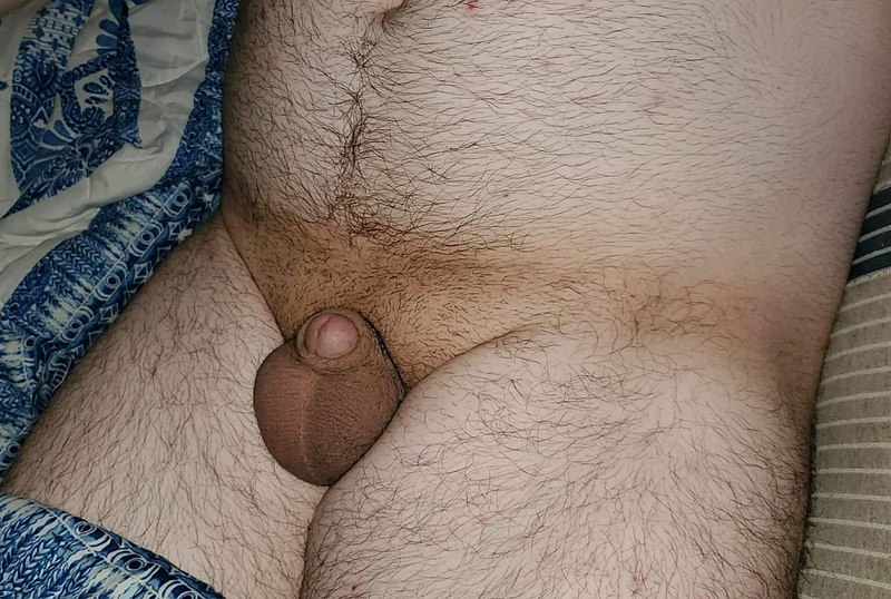 Micropenis picture