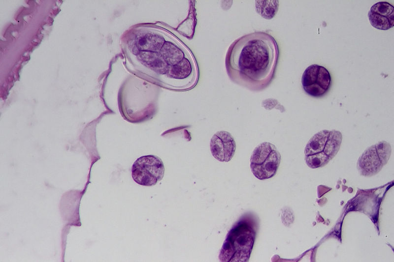 File:Oxyuriasis of the appendix vermiformis, HE 18.jpg