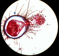 Zich openend cleistothecium van echte meeldauw (Microsphaera)