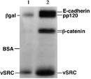 Gel de SDS-PAGE