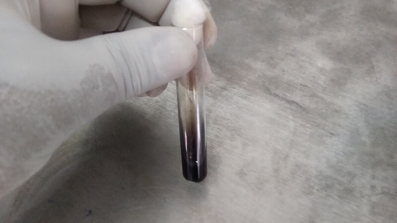 File:Sphingobacterium Esculin Test- Positive.jpg