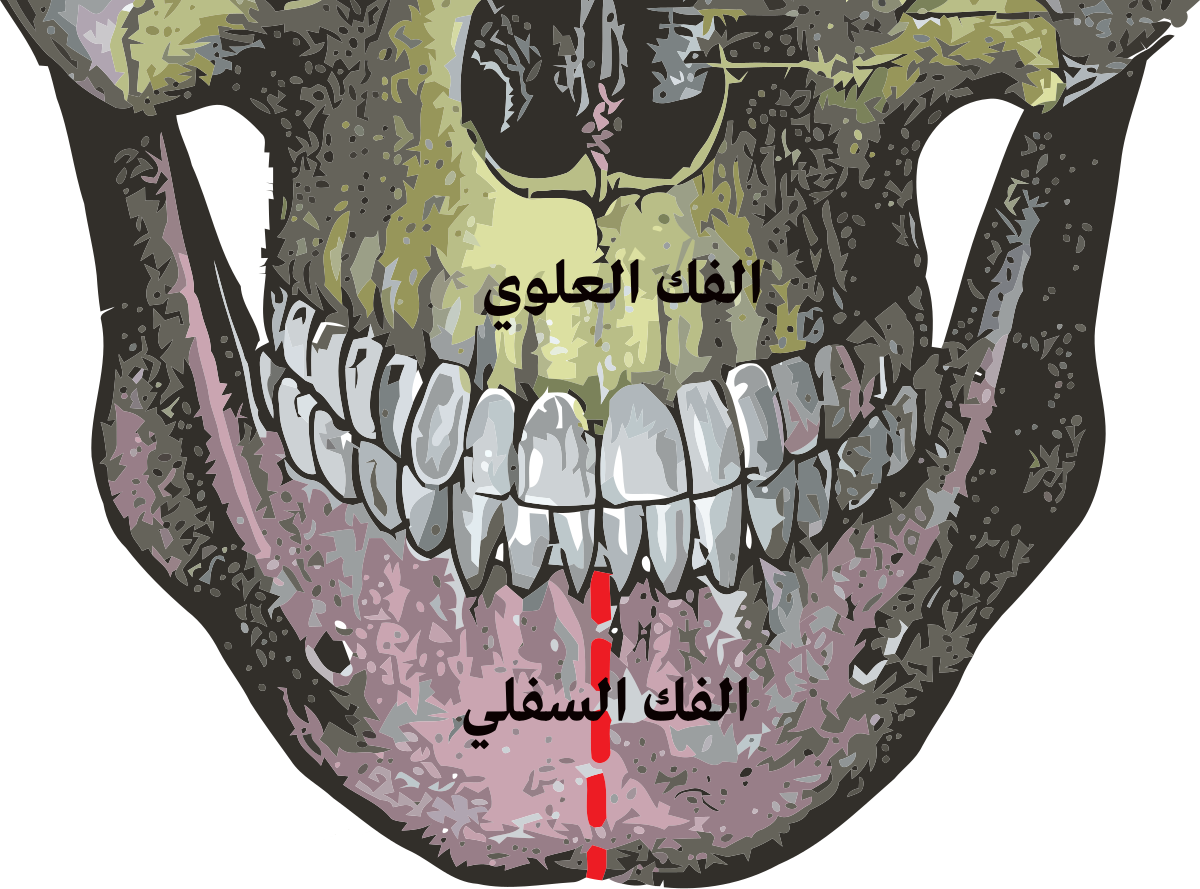 Подъязычная линия нижней челюсти. Нижнечелюстной симфиз. Симфиз нижней челюсти. Подбородочный симфиз нижней челюсти.