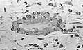 Mikrofotografi av osteoblastar, med synlege golgiapparat som formar ein osteoid i midten av ein nidus.