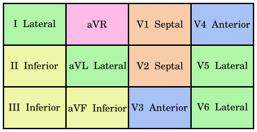 File:Contiguous leads.svg