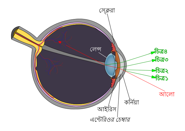 File:Diagram of four Purkinje images-bn.svg