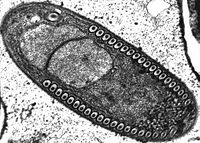 Spora jedne  Microsporidia.