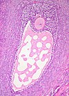 Graafian Follicle, Human Ovary (3595817584) .jpg