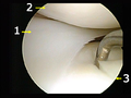 Thumbnail for version as of 14:56, 11 July 2008