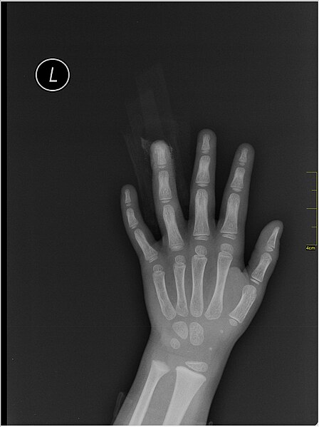 File:Medical X-Ray imaging POR06 nevit.jpg