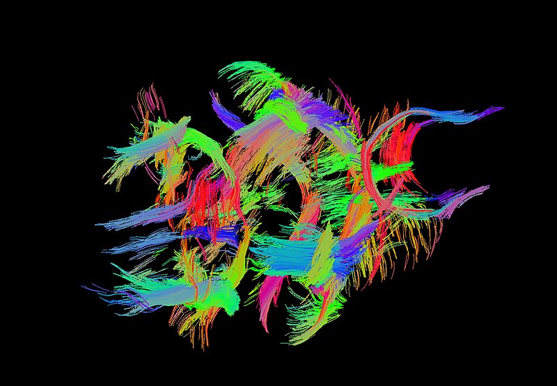 File:Mouse Tractography.jpg