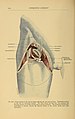 Text-book of operative surgery (1903) (14577812490).jpg