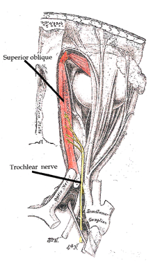 מהלך עצב הסליל, אשר מעצבב את שריר האלכסון העליון (Superior oblique muscle)