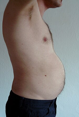 Abdominal obesity in men.jpg