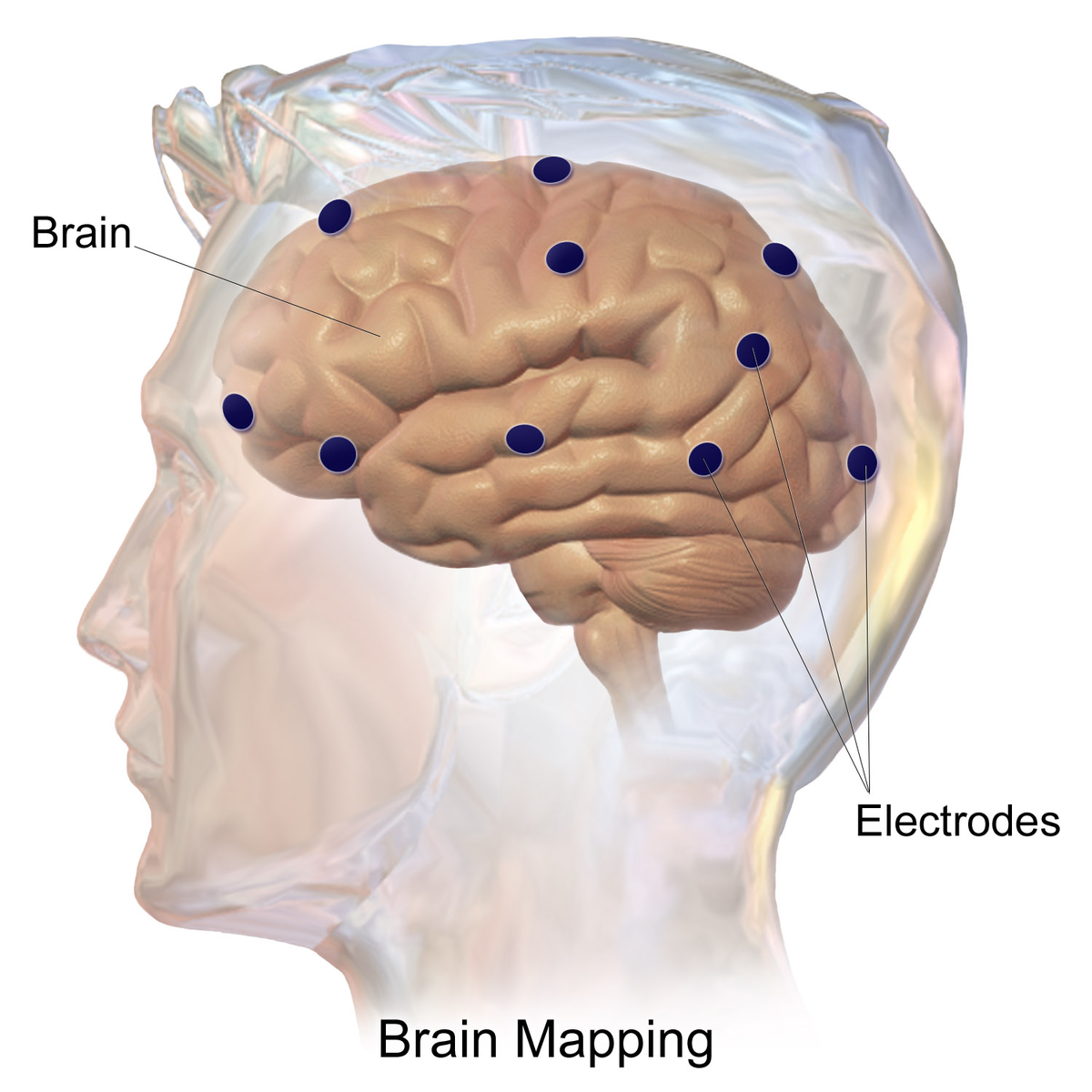 Картирование головного мозга — Википедия
