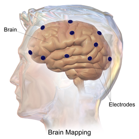 Blausen 0113 BrainMapping Electrodes.png