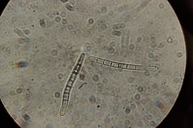 Cercospora beticola