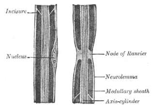 Myelin incisure Regions within compact myelin in which the cytoplasmic faces of the enveloping myelin sheath are not tightly juxtaposed, and include cytoplasm from the cell responsible for making the myelin. Schmidt-Lanterman incisures occur in the compact myelin in