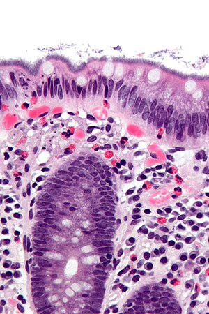 Intestinale spirochetose - bijgesneden - zeer hoge mag.jpg